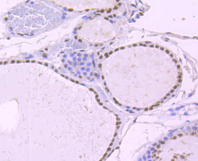 NRF1 Rabbit mAb