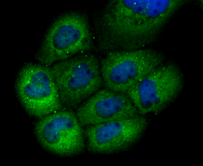 GCLM Rabbit mAb