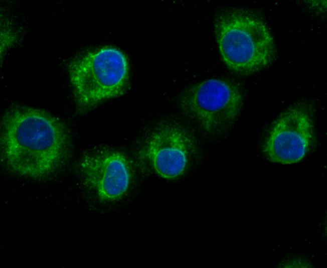 GCLM Rabbit mAb