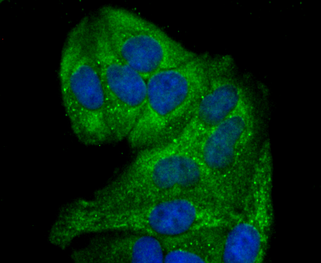 GCLM Rabbit mAb