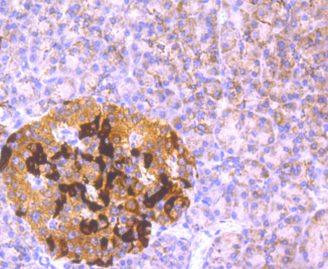 GCLM Rabbit mAb