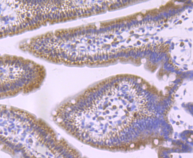 GCLM Rabbit mAb