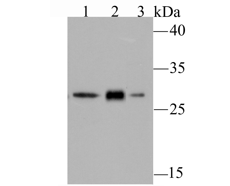 GCLM Rabbit mAb