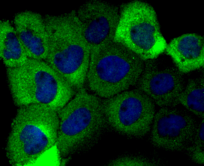 Aldolase Rabbit mAb