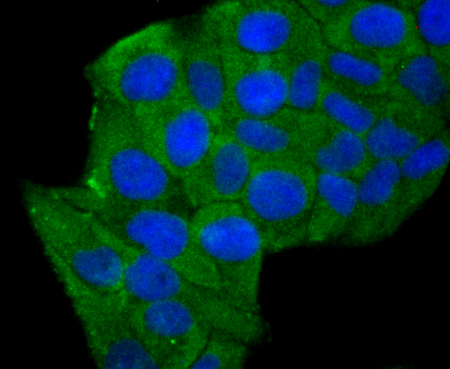 Aldolase Rabbit mAb