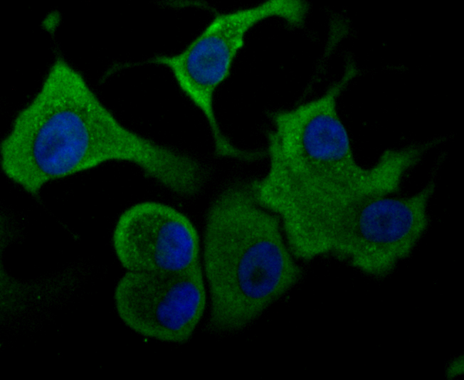 Aldolase Rabbit mAb