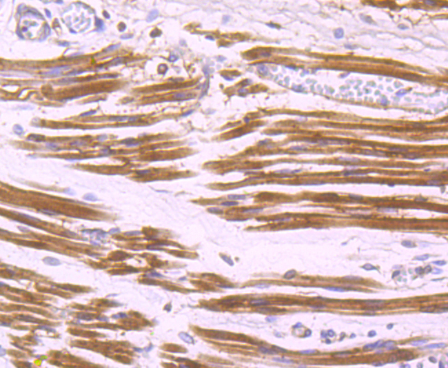 Aldolase Rabbit mAb