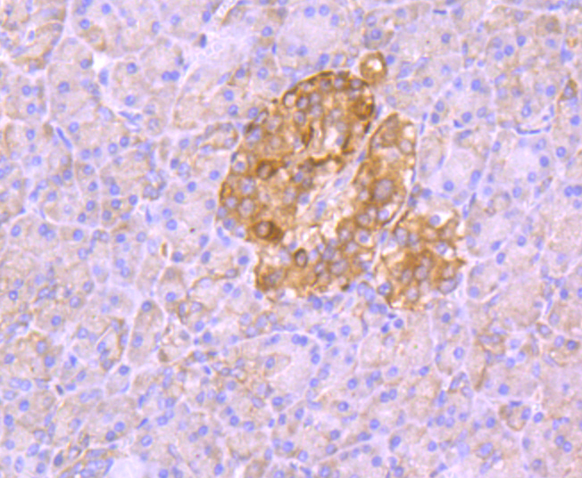 Aldolase Rabbit mAb