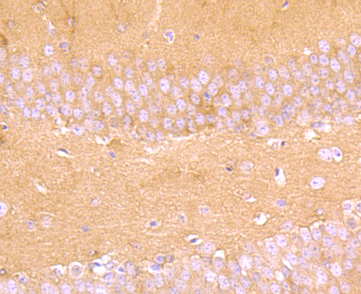 Aldolase Rabbit mAb