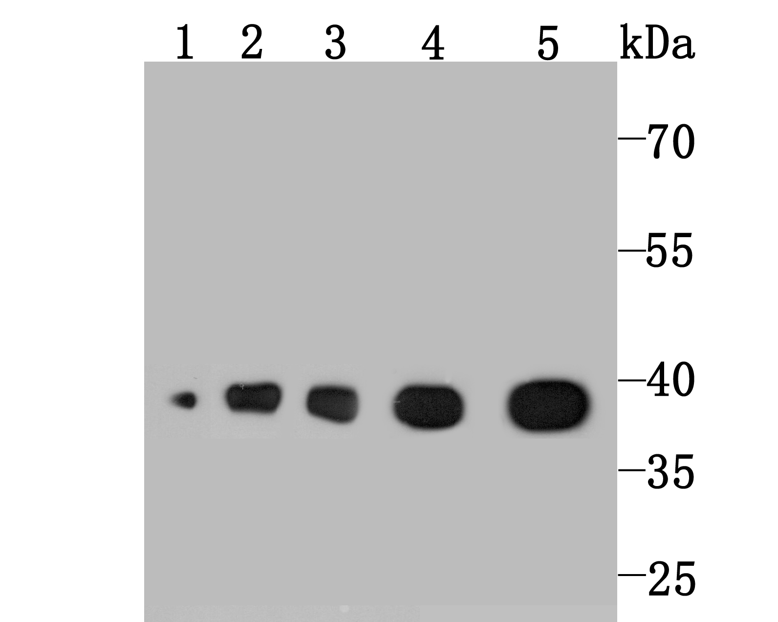 Aldolase Rabbit mAb