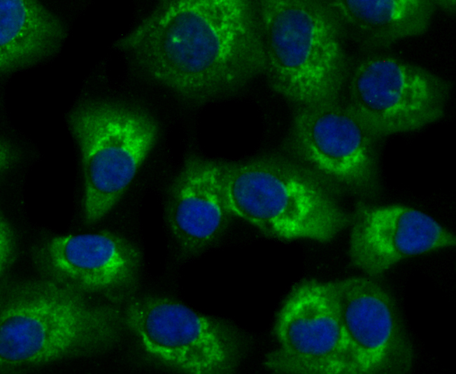 TLR2 Rabbit mAb