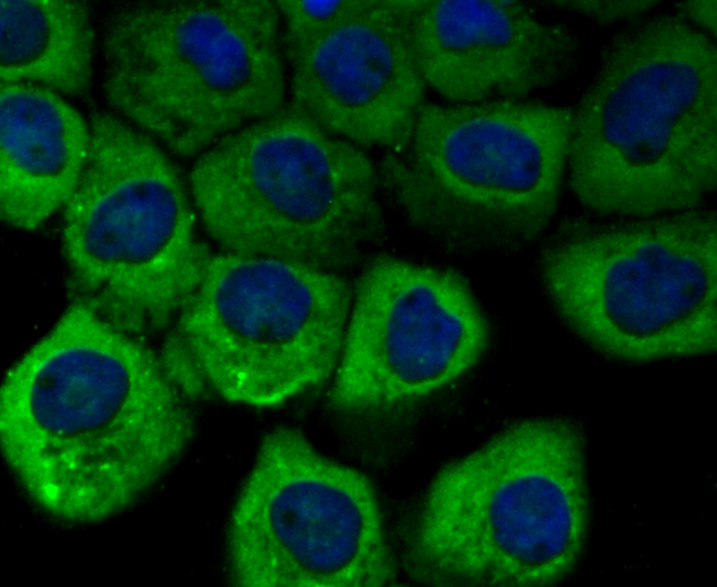 Vinculin Rabbit mAb