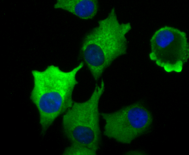 Vinculin Rabbit mAb