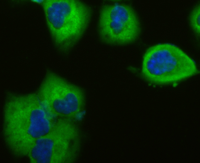 Vinculin Rabbit mAb