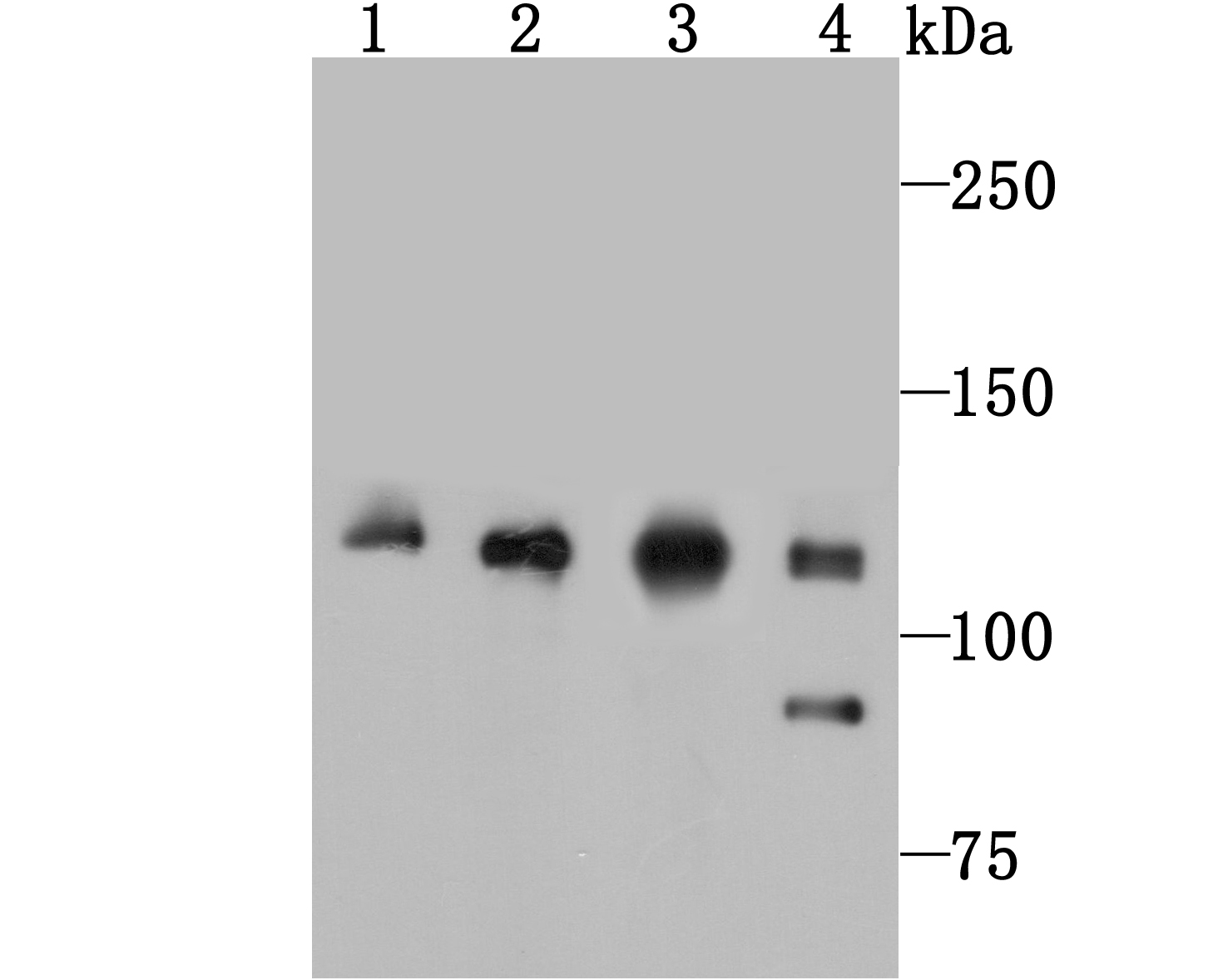 Vinculin Rabbit mAb