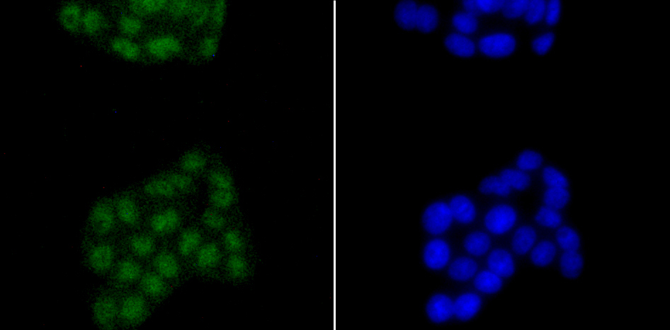 SATB2 Rabbit mAb