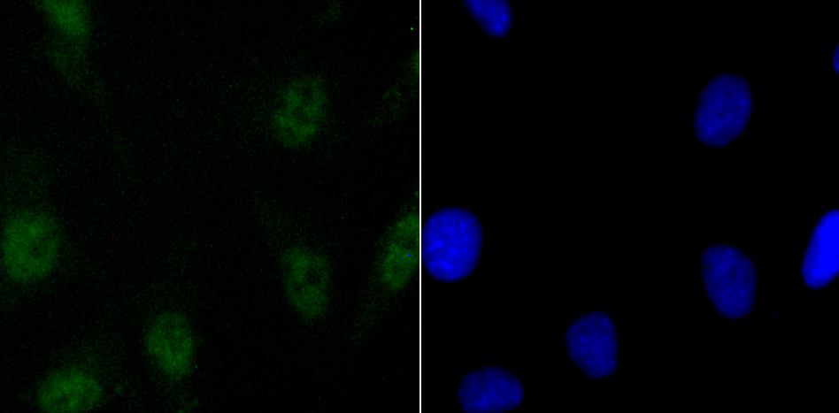 SATB2 Rabbit mAb