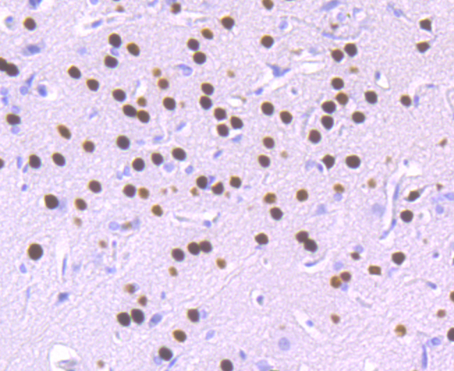 SATB2 Rabbit mAb