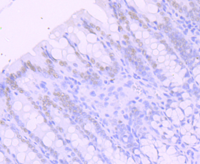 SATB2 Rabbit mAb