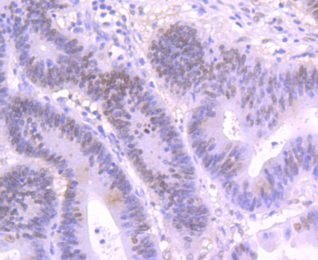 SATB2 Rabbit mAb