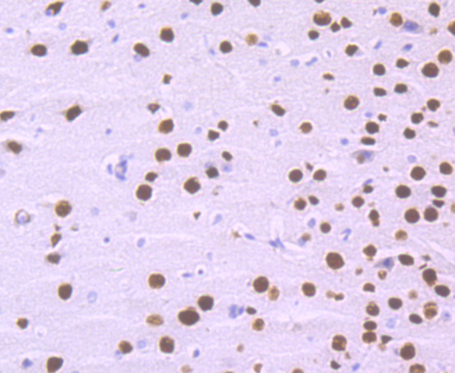 SATB2 Rabbit mAb