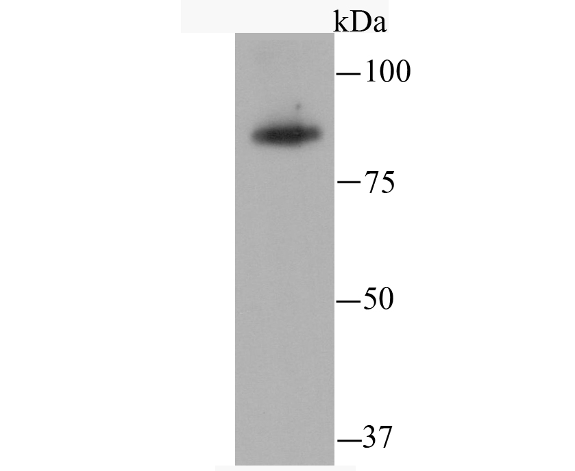 SATB2 Rabbit mAb