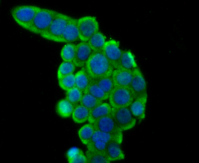 Rad51 Rabbit mAb