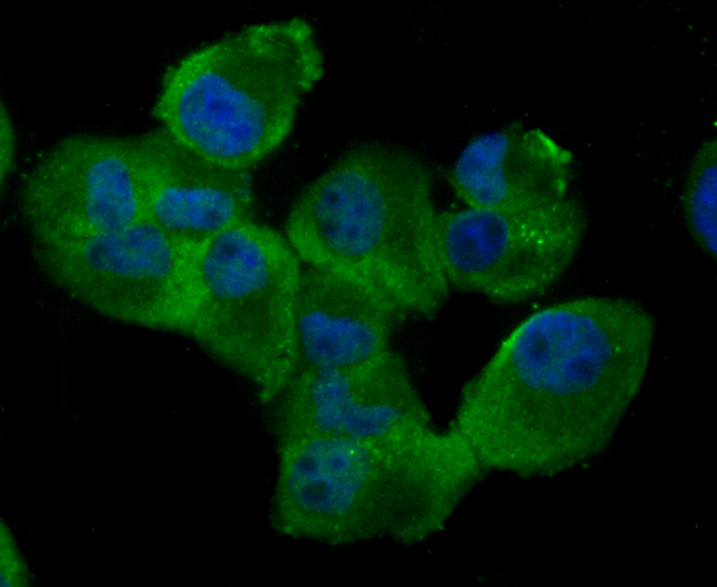 Rad51 Rabbit mAb