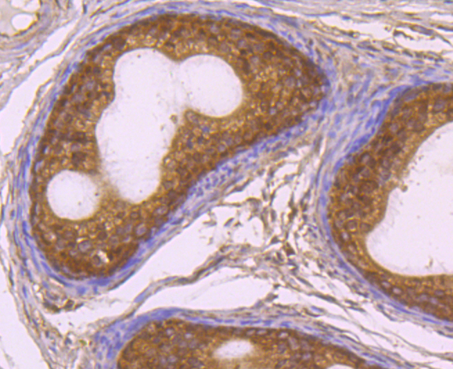 Rad51 Rabbit mAb