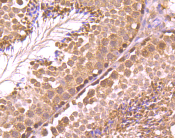 Rad51 Rabbit mAb