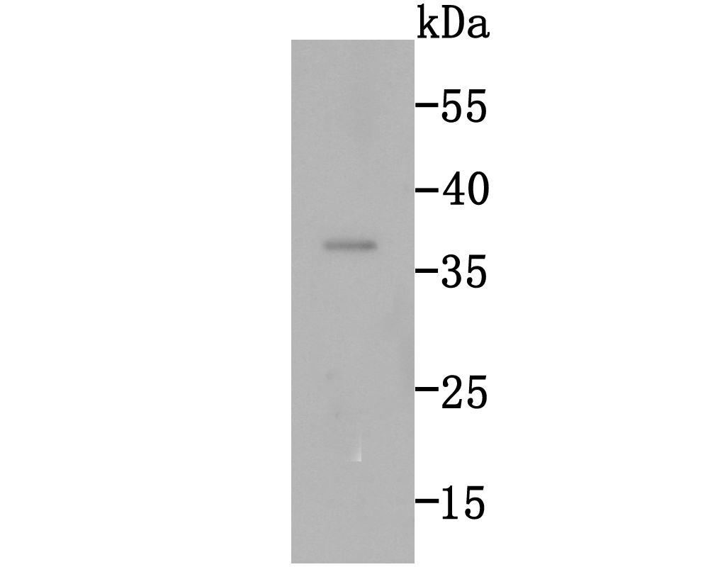 Rad51 Rabbit mAb