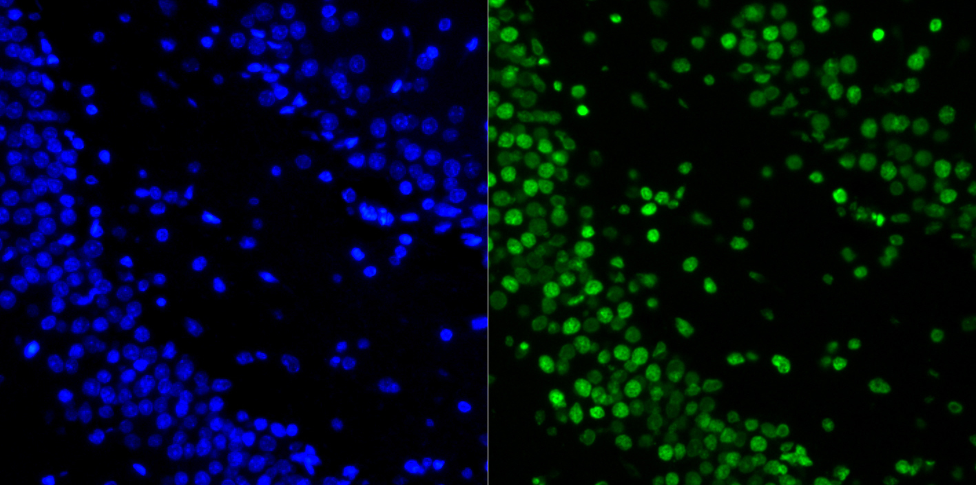 Histone H2A.X Rabbit mAb