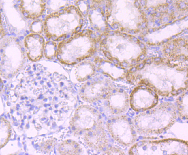 MMP3 Rabbit mAb