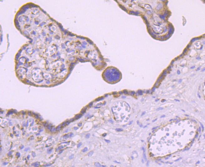 MMP3 Rabbit mAb