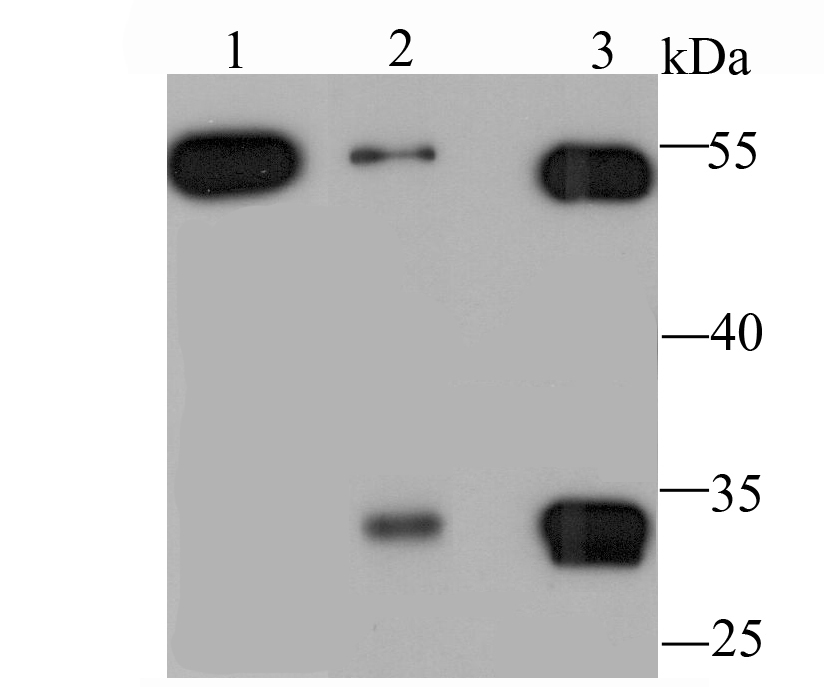 MMP3 Rabbit mAb