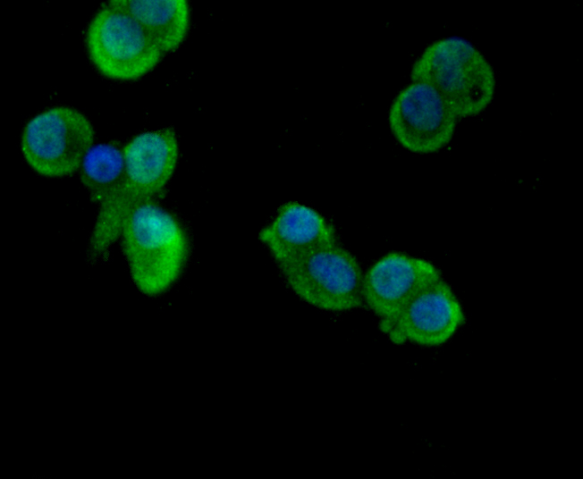 CD11b Rabbit mAb