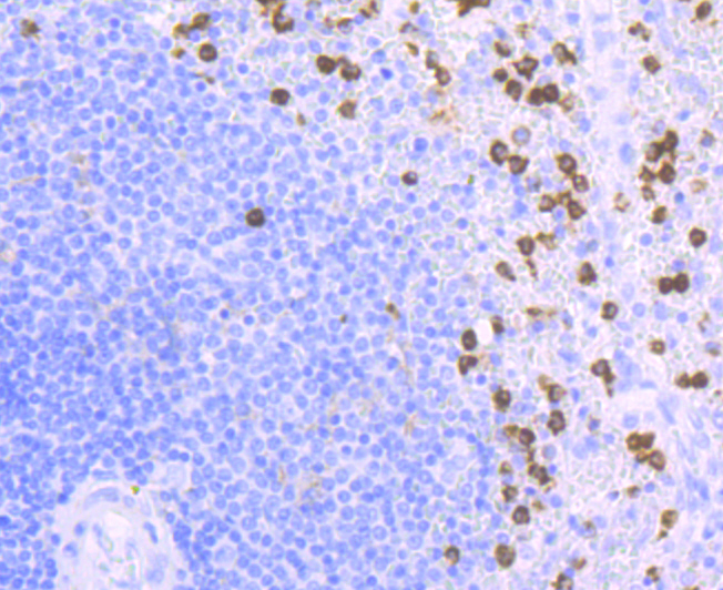 CD11b Rabbit mAb