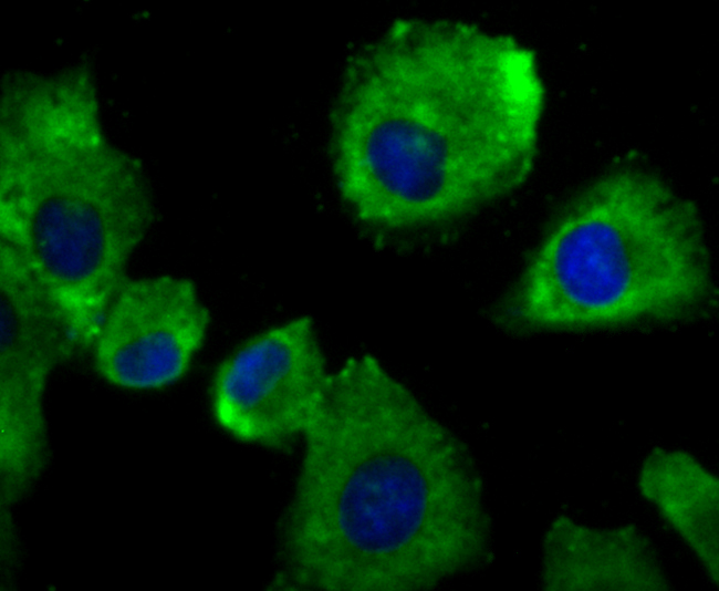 alpha Actinin 4 Rabbit mAb