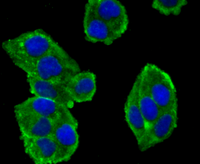 alpha Actinin 4 Rabbit mAb