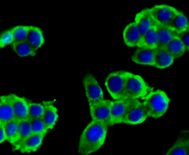 alpha Actinin 4 Rabbit mAb