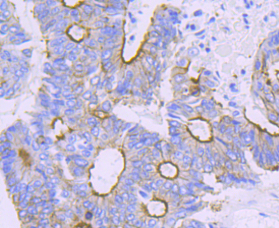 alpha Actinin 4 Rabbit mAb