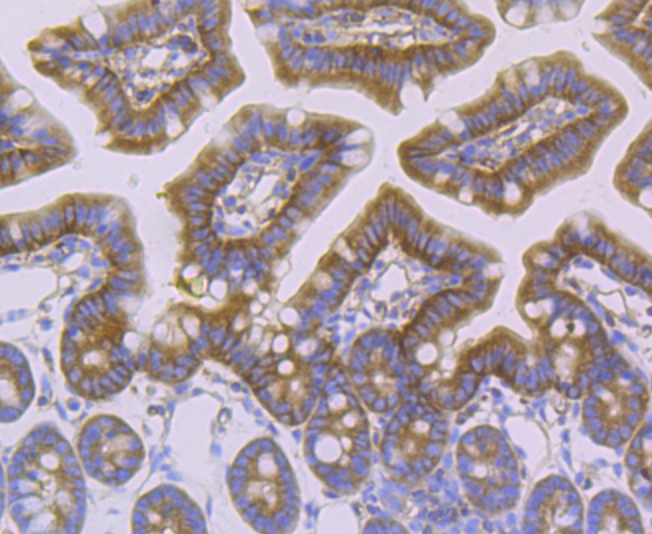 alpha Actinin 4 Rabbit mAb