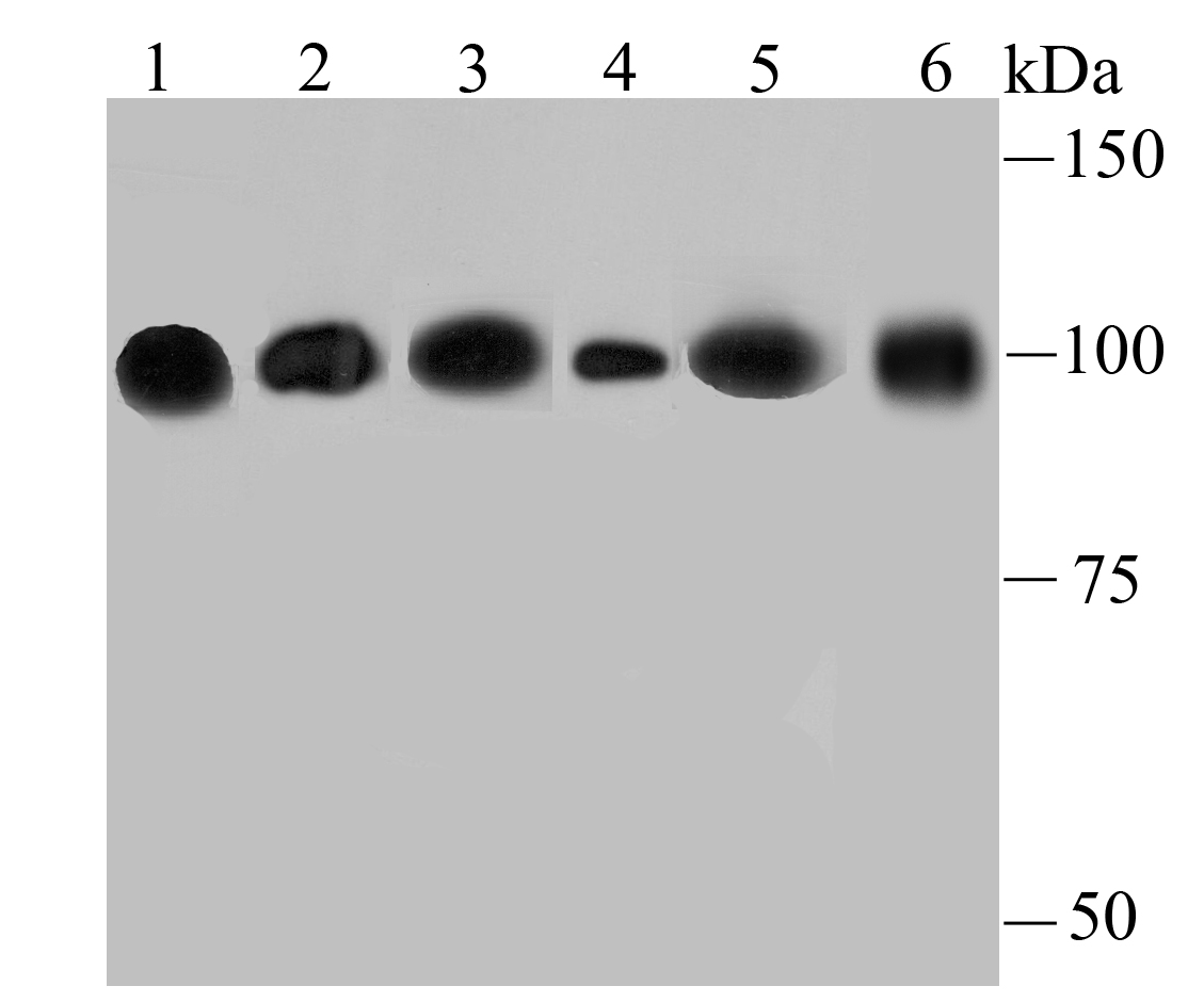 alpha Actinin 4 Rabbit mAb