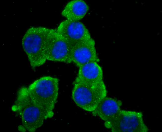 GluR2 Rabbit mAb