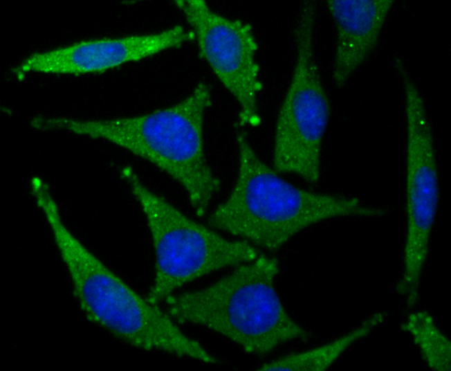 GluR2 Rabbit mAb