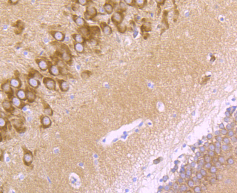 GluR2 Rabbit mAb