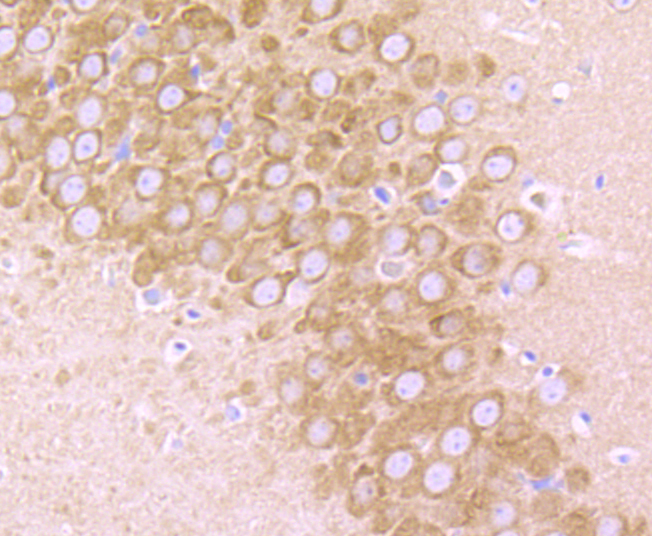 GluR2 Rabbit mAb