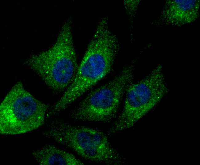 NDUFS3 Rabbit mAb