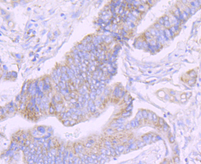 NDUFS3 Rabbit mAb