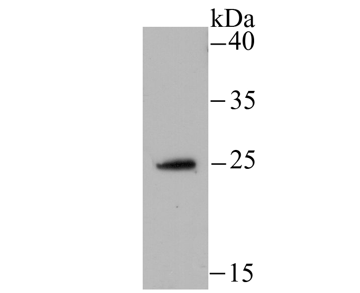 NDUFS3 Rabbit mAb